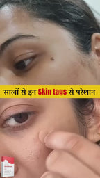 DermaSmooth Skin Care  Patch 1 +1 Free